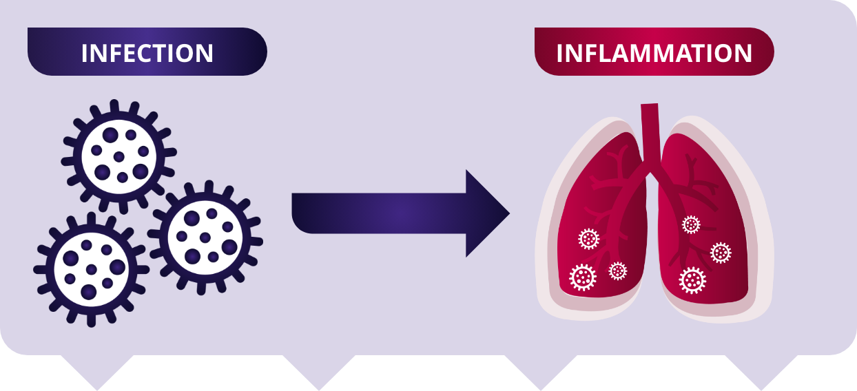 Illustration showing infectious bacteria causing lung inflammation